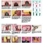 Impression and Temporization Options