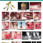 Guided Surgery Sheet