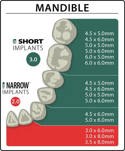 Implants by Indication